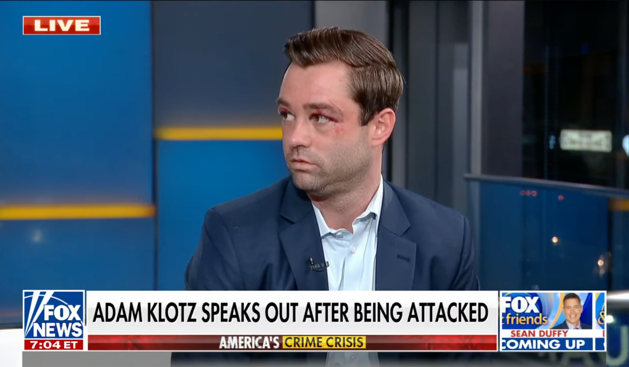 Fox Meteorologist Adam Klotz Attacked On New York City Subway ...